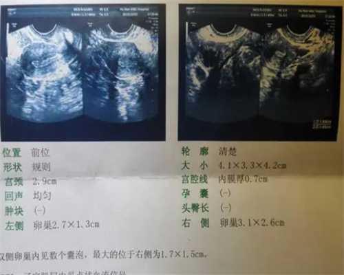北京代怀靠谱吗,北京供卵公司有哪些？附2023北京试管助孕医院排名！